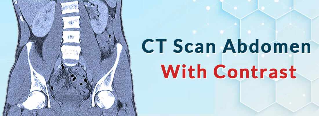 CT Scan Abdomen With Contrast